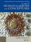 An Atlas of Human Gametes and Conceptuses: An Illustrated Reference for Assisted Reproductive Technology (BAR International) By Lucinda L. Veeck (Editor) Cover Image