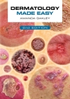 Dermatology Made Easy, second edition By Amanda Oakley Cover Image