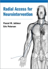 Radial Access for Neurointervention Cover Image