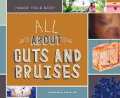 All about Cuts and Bruises (Inside Your Body) By Potts Francesca Rn Cover Image