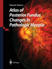 Atlas of Posterior Fundus Changes in Pathologic Myopia By Takashi Tokoro Cover Image