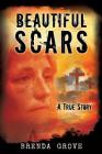 Beautiful Scars By Brenda Grove Cover Image