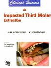 Clinical Success in Impacted Third Molar Extraction By J. -M Korbendau, X. Korbendau, M. -P Hippolyte (Translator) Cover Image