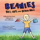 Beanies, Ball Caps, and Being Bald: Different Isn't Bad, Different Is Just Different Cover Image