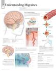 Understanding Migraines Chart: Laminated Wall Chart Cover Image