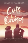 Cuts and Bruises Cover Image