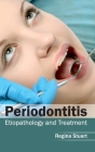 Periodontitis: Etiopathology and Treatment By Regina Stuart (Editor) Cover Image