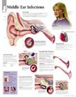 Middle Ear Infection Chart: Laminated Wall Chart Cover Image