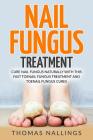 Nail Fungus Treatment: Cure Nail Fungus Naturally with This Fast Toenail Fungus Treatment and Toenail Fungus Cures By Thomas Nallings Cover Image