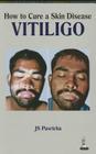 How to Cure a Skin Disease: Vitiligo By Js Pasricha Cover Image