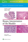 Biopsy Interpretation of the Bladder (Biopsy Interpretation Series) By Jonathan I. Epstein, Victor E. Reuter, MD, Mahul B. Amin Cover Image