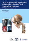 Cervical Spondylotic Myelopathy and Ossification of Posterior Longitudinal Ligament: Wfns Spine Committee Book By Mehmet Zileli (Editor), J. K. B. C. Parthiban (Editor) Cover Image