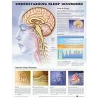 Understanding Sleep Disorders Anatomical Chart Cover Image