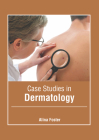 Case Studies in Dermatology By Alina Foster (Editor) Cover Image