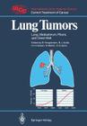 Lung Tumors: Lung, Mediastinum, Pleura, and Chest Wall (Uicc Current Treatment of Cancer) By Barth Hoogstraten (Editor), B. J. Addis (Contribution by), M. S. Bains (Contribution by) Cover Image