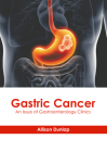 Gastric Cancer: An Issue of Gastroenterology Clinics By Allison Dunlap (Editor) Cover Image