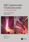 Safe Laparoscopic Cholecystectomy: An Illustrated Atlas Cover Image