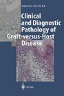 Clinical and Diagnostic Pathology of Graft-Versus-Host Disease Cover Image