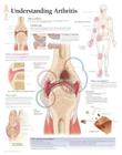 Understanding Arthritis Chart: Wall Chart Cover Image