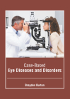 Case-Based Eye Diseases and Disorders By Brayden Burton (Editor) Cover Image