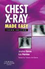Chest X-Ray Made Easy Cover Image