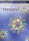 What Is Herpes? By Kathleen Connors Cover Image