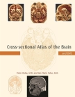 Cross-Sectional Atlas of the Brain and DVD [With DVD-ROM] Cover Image
