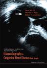 Echocardiography in Congenital Heart Disease Made Simple (Cardiopulmonary Medicine from Imperial College Press) Cover Image