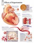 Effects of Hypertension Chart: Wall Chart Cover Image