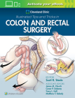 Cleveland Clinic Illustrated Tips and Tricks in Colon and Rectal Surgery Cover Image