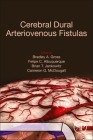 Cerebral Dural Arteriovenous Fistulas Cover Image