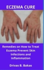 Eczema Cure: Remedies on How to Treat Eczema, Prevent Skin Infections and Inflammation Cover Image