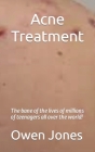 Acne Treatment (How To...) By Owen Jones Cover Image
