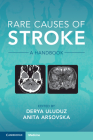 Rare Causes of Stroke: A Handbook Cover Image