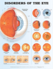 Disorders of the Eye Anatomical Chart Cover Image