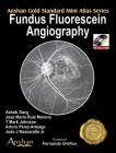 Fundus Fluorescein Angiography [With Mini CDROM] (Anshan Gold Standard Mini Atlas) Cover Image