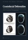 Craniofacial Deformities: Atlas of Three-Dimensional Reconstruction from Computed Tomography By David J. David, David C. Hemmy, Rodney D. Cooter Cover Image
