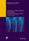 Revision of Loose Femoral Prostheses with a Stem System Based on the 