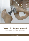 Total Hip Replacement: Techniques and Complications By Fisher Lloyd (Editor) Cover Image