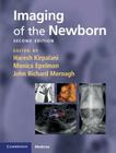 Imaging of the Newborn (Cambridge Medicine) By Haresh Kirpalani (Editor), Monica Epelman (Editor), John Richard Mernagh (Editor) Cover Image