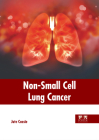 Non-Small Cell Lung Cancer By Jute Cassie (Editor) Cover Image
