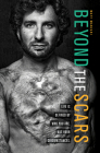 Beyond the Scars: Life is Defined by Who You Are, Not Your Circumstances By Matt Manzari Cover Image