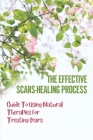 The Effective Scars-Healing Process: Guide To Using Natural Therapies For Treating Scars: Learn About Scar By Kent Chryst Cover Image