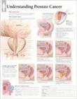 Understanding Prostate Cancer Wall Chart By Various Cover Image