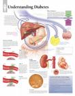 Understanding Diabetes Chart: Laminated Wall Chart Cover Image