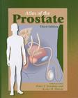 Atlas of the Prostate By W. Vetter (Director), W. Langenfeld (Illustrator), W. C. Jr. Whitman (Cover Design by) Cover Image