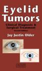 Eyelid Tumors Cover Image