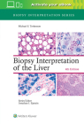 Biopsy Interpretation of the Liver (Biopsy Interpretation Series) Cover Image