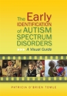 The Early Identification of Autism Spectrum Disorders: A Visual Guide By Patricia O'Brien O'Brien Towle Cover Image