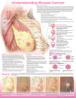 Understanding Breast Cancer Anatomical Chart By Anatomical Chart Company		 (Prepared for publication by) Cover Image